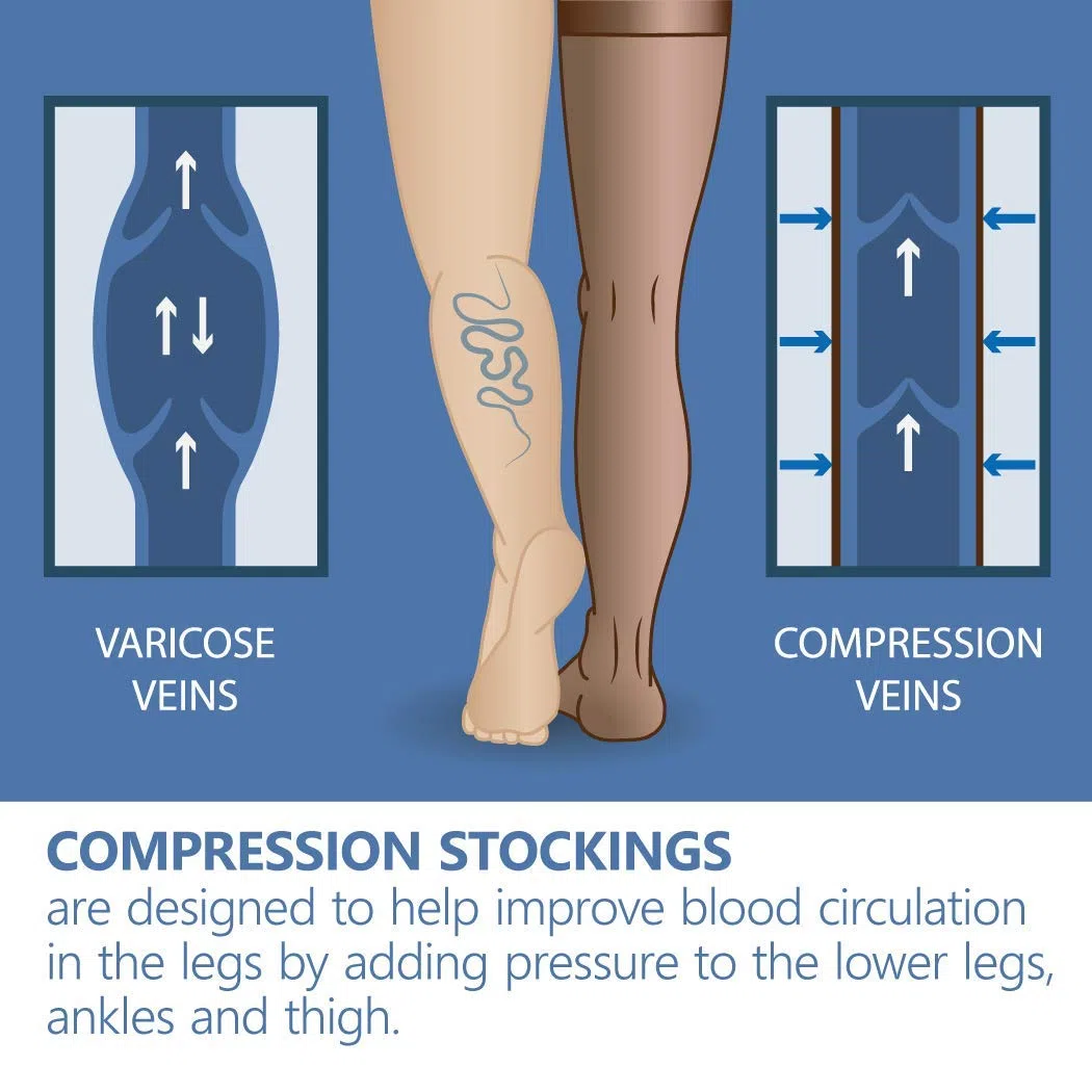 Bas de contention Elastiques Compression graduée à bout ouvert (classe médicale 2, 23-32 mmHG) pour femmes hommes Anti-thrombose Beige X-Large