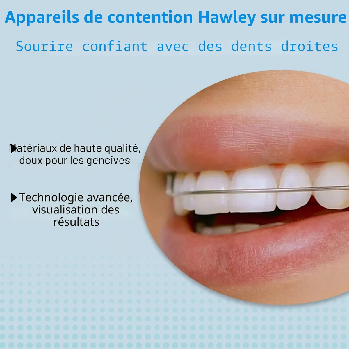 Gouttière de Hawley sur mesure, confortable et durable, sans BPA, adaptée aux adultes et aux enfants, Empêche le déplacement des dents, pour mâchoire supérieure et inférieure - Rose (2 pièces)