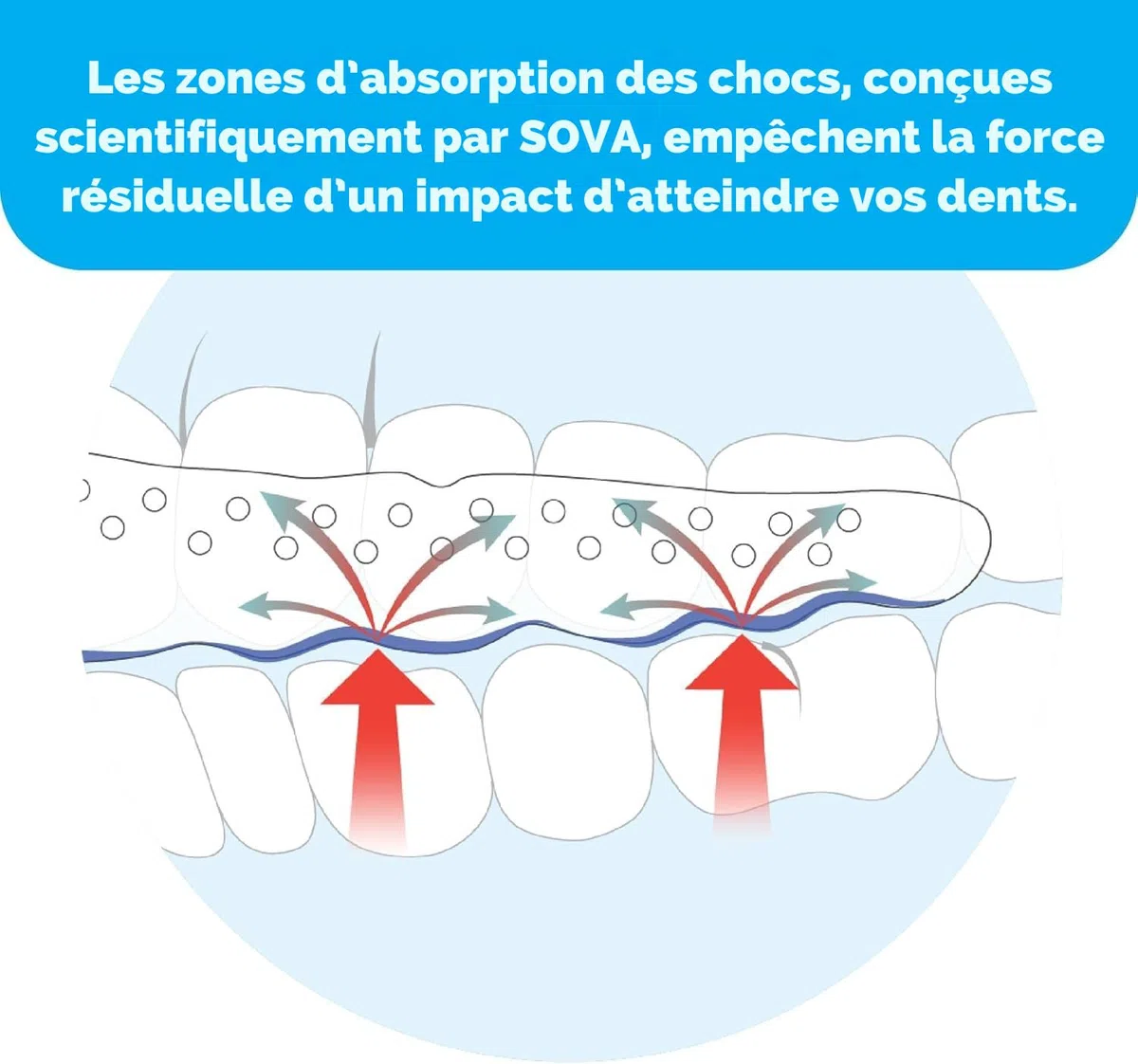 SOVA Aero Night Guard – Gouttière Dentaire contre le grincement nocturne/bruxisme - Protège-dents ajustable - 1.6mm - Remodelable jusqu'à 20 fois - Pour adultes - Avec son étui