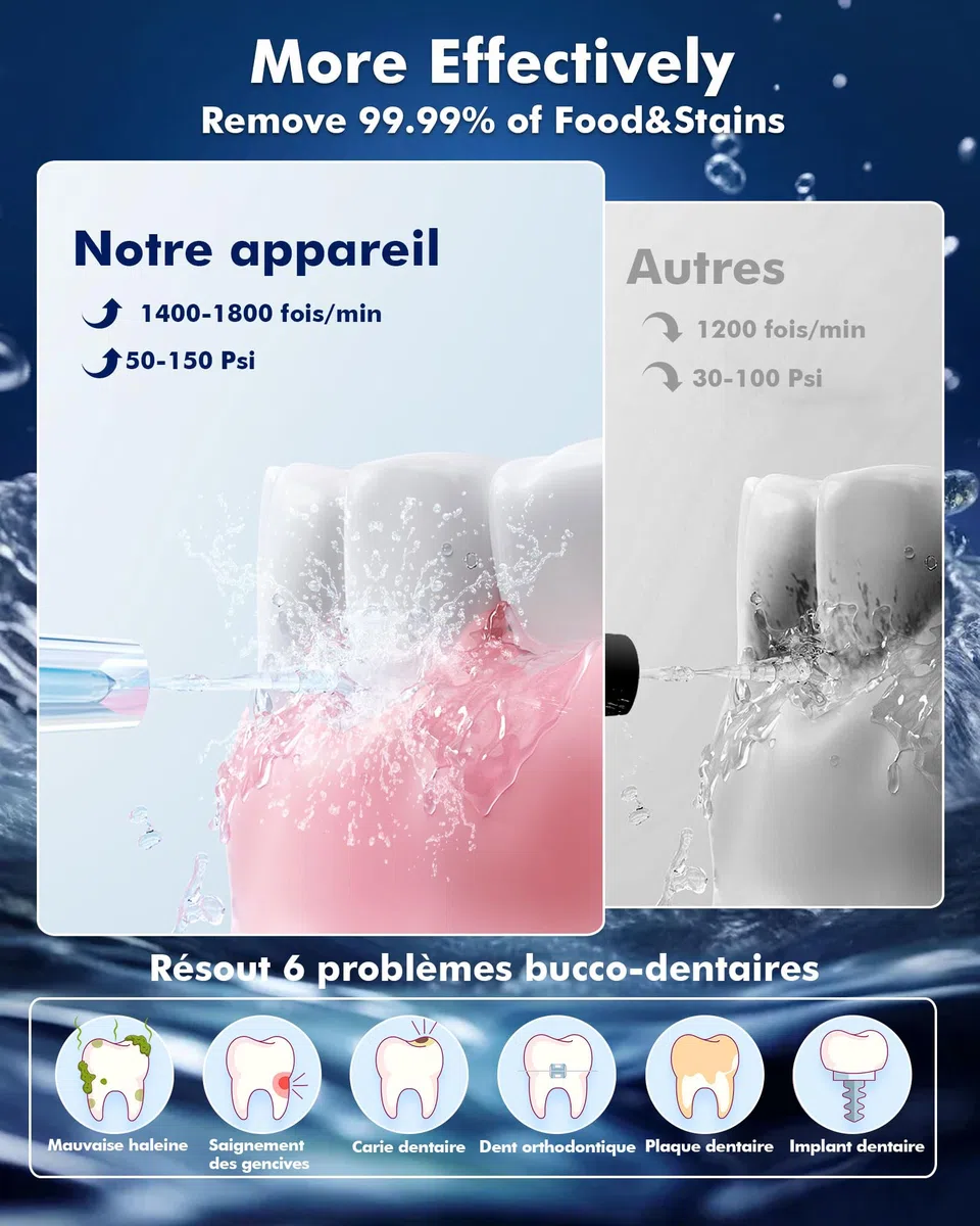 Jet Dentaire Hydropulseur, 5 Modes, 6 Embouts, Rechargeable, Portable, Réservoir de 300ML, Flosser Électrique, Étanchéité IPX7, Nettoyage des Dents Idéal pour Maison et Voyage (Noir)