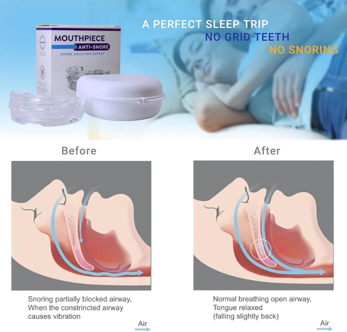 Sofela AirFlow - Anti Ronflement Efficace Puissant (Bleu)