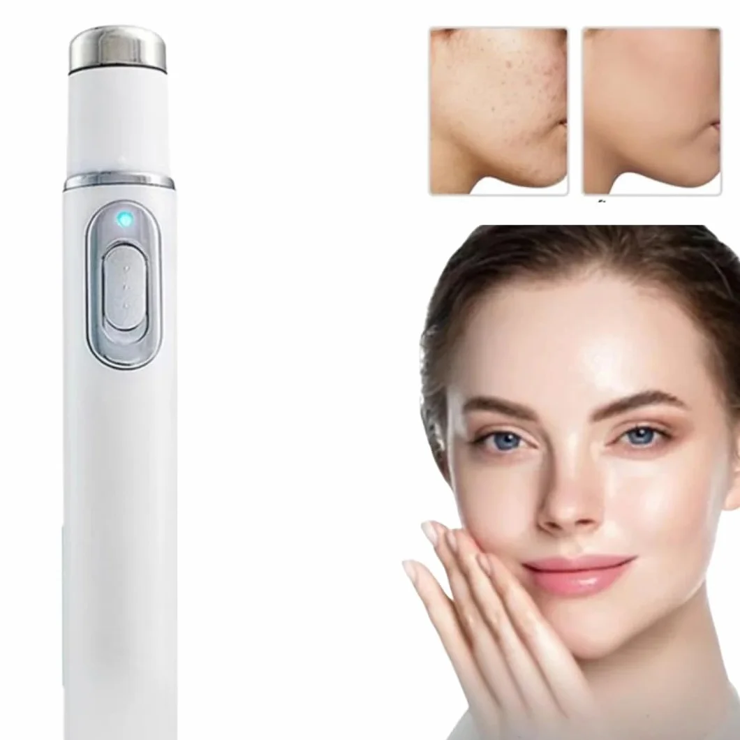 Générique Dispositif De Traitement des Varices Non Invasif, équipement De Traitement des Varices Au Laser, Dispositif Laser pour Varices à Domicile (1x - Single)
