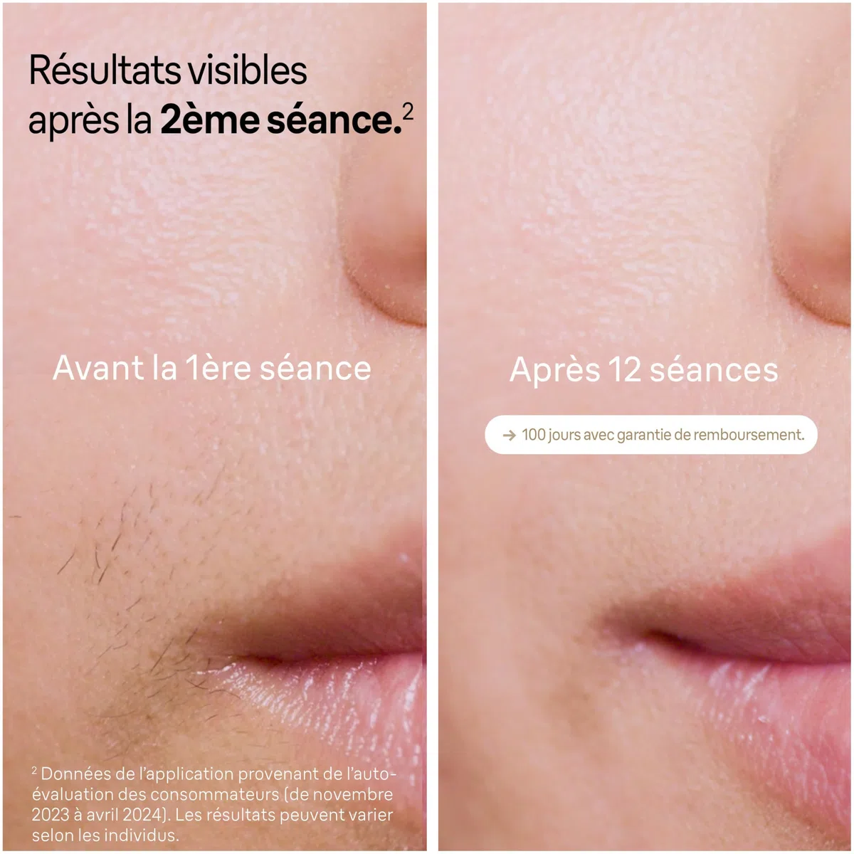 Braun Epilateur Lumiere Pulsee Silk·expert Pro 5 PL5382, Blanc et Or | Alternative au Laser à Domicile, Filaire, avec Pochette, Rasoir Gillette Venus, 4 Têtes