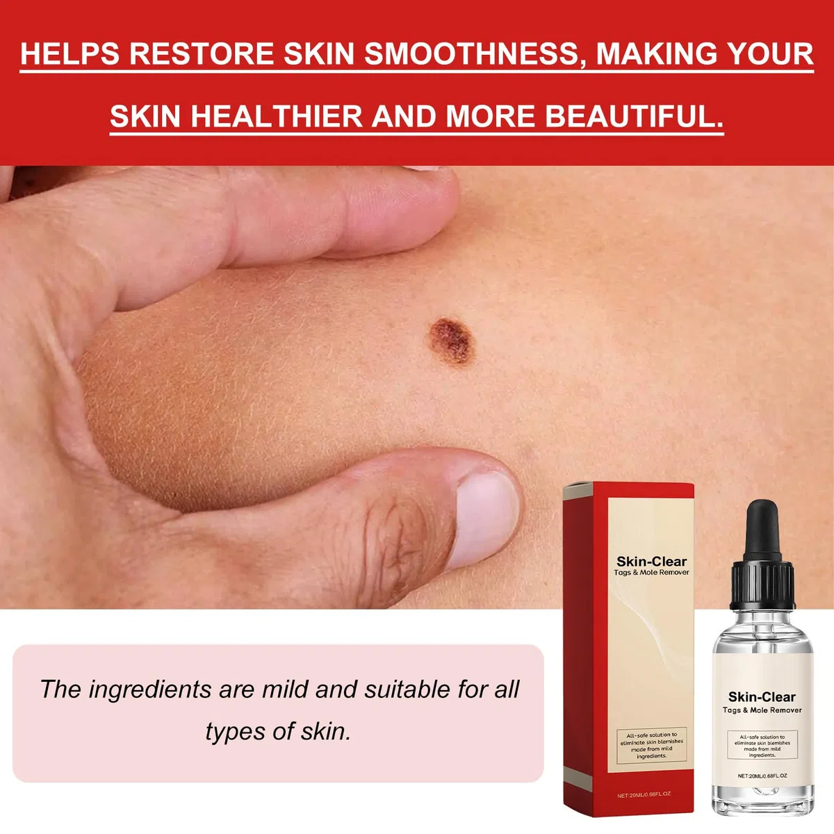 Lotion pour Enlever les Taches Noires de Naevus et les Taches Sombres, Crème Anti-Taupes et Verrues, 20 ml