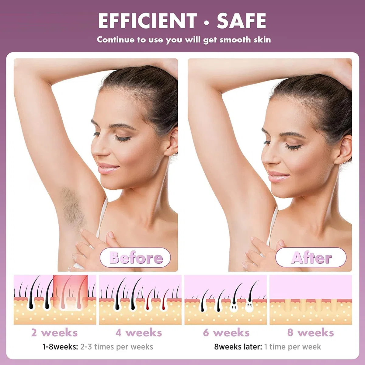 AMINZER Épilateur Lumière Pulsée de Glace, Épilateur Laser Definitive avec 999,900 Flashes, 2 Modes et 5 Niveaux D'énergie IPL Épilateur pour Femme et Homme, Visage, Corps, Bikini, Aisselles