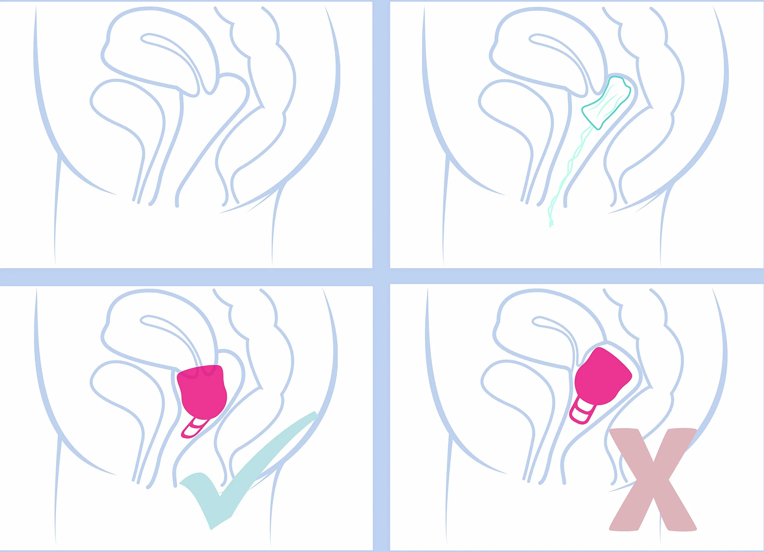 Merula Cup XL strawberry (rose) - La coupe menstruelle pour les journées intenses