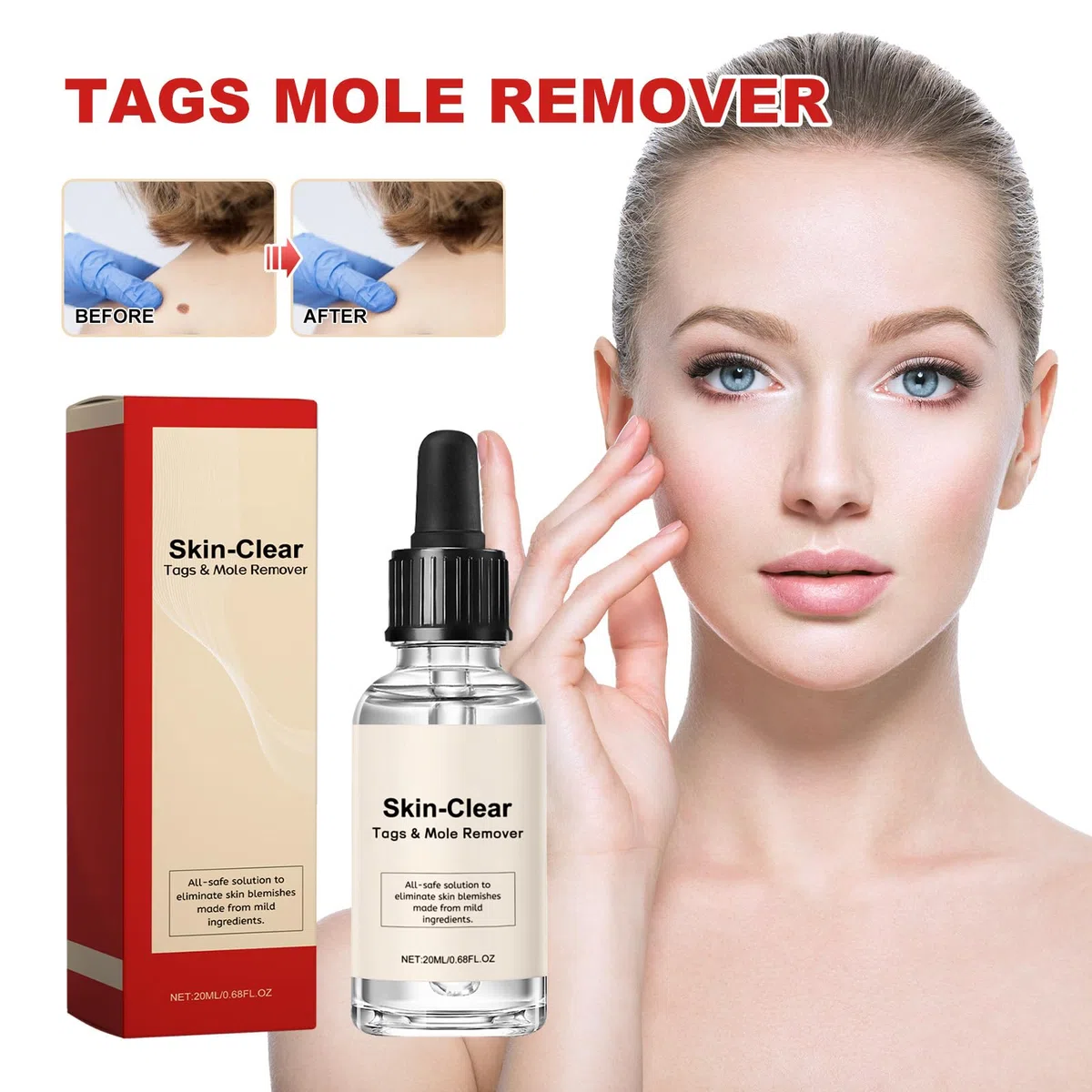 Lotion pour Enlever les Taches Noires de Naevus et les Taches Sombres, Crème Anti-Taupes et Verrues, 20 ml