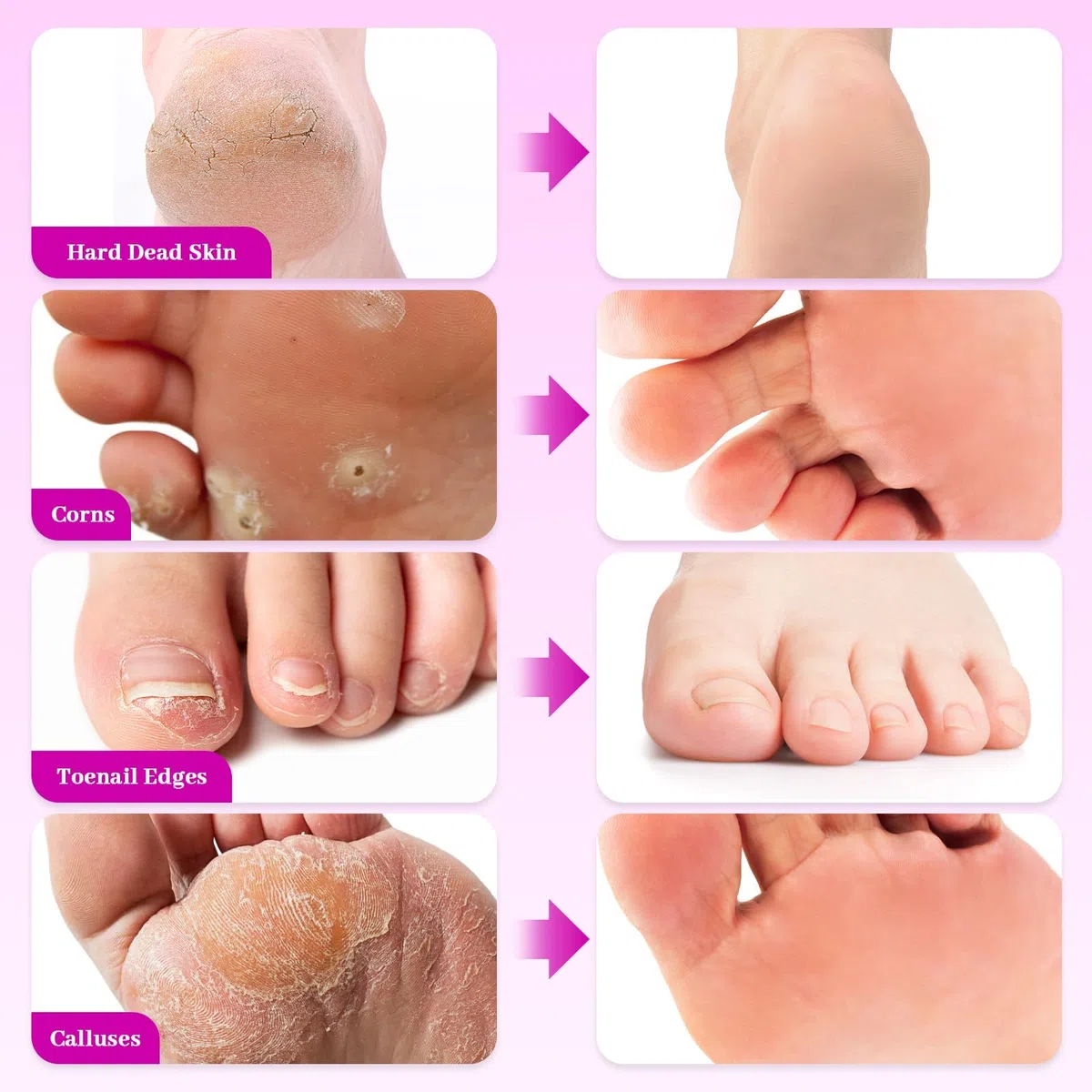 Ponceuse Pieds Electrique – Râpe Électrique Pieds sans Pile avec Vitesse Réglable, 60 Disques Abrasifs & Brosse – Pour Callosités, Talons Secs et Peau Morte (Rose pâle)