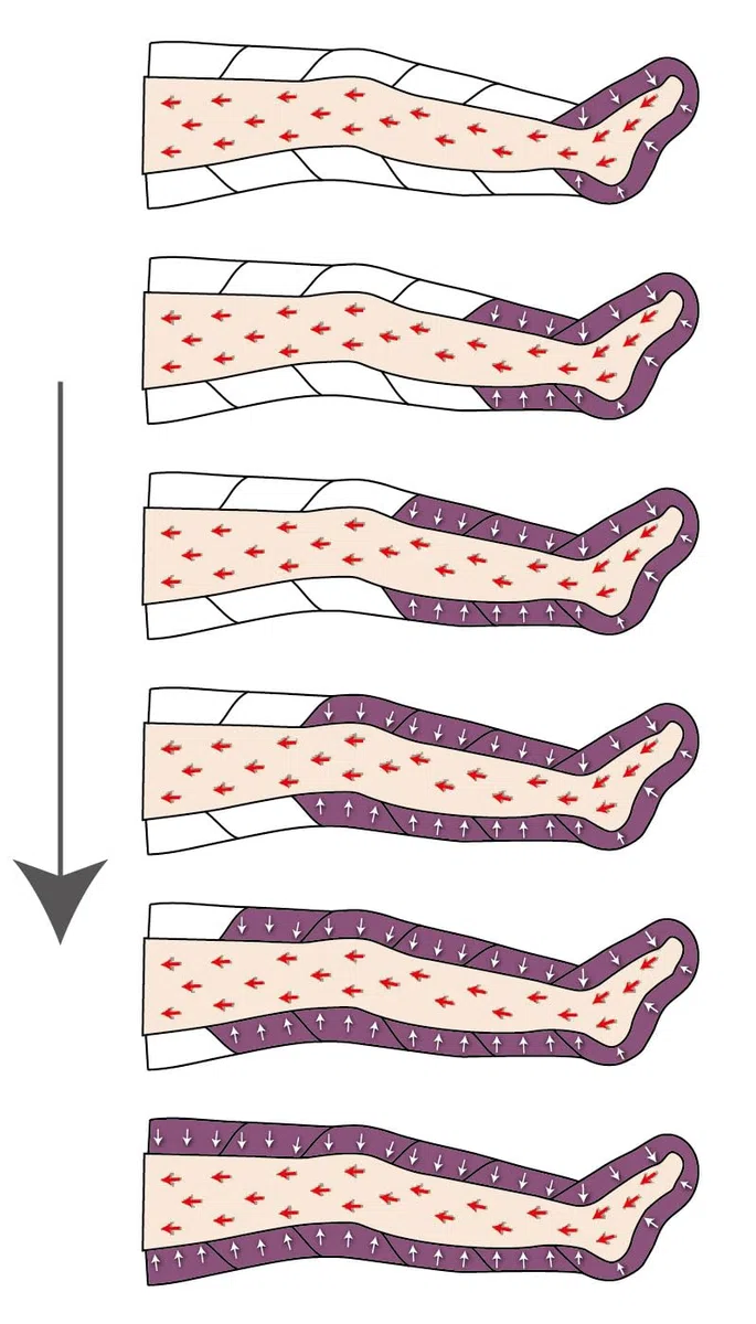 MESIS PressoMedical 1.0 SIX6 à 6 chambres Équipé PRO (avec 2 jambières, 1 bande abdominale/fessier et 1 brassard, pressothérapie lymphodrainage)