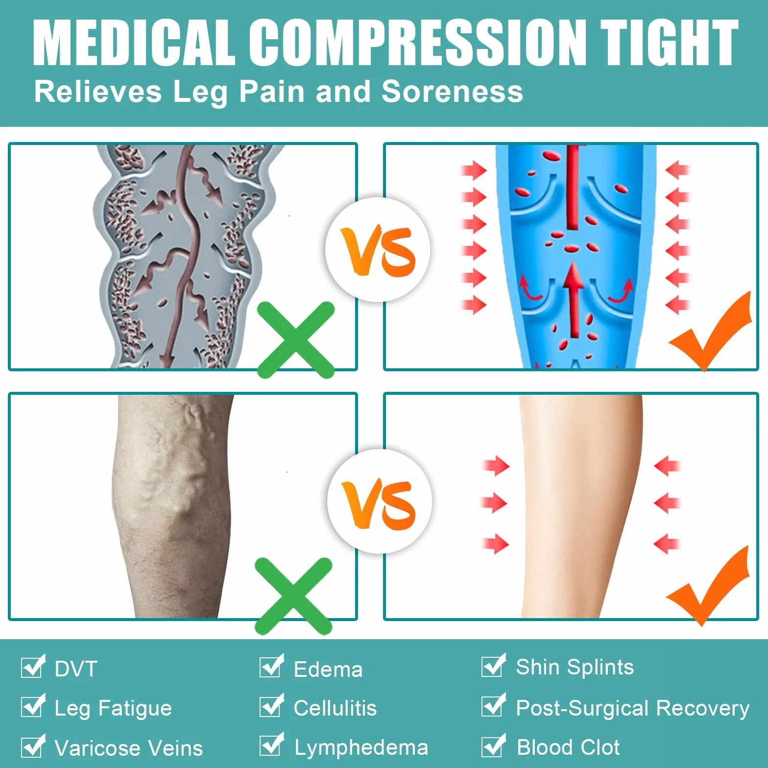 Bas de compression médicaux pour homme et femme - Longueur : 20 à 30 mmHg - Classe II - Collants de compression gradués - Bas de contention - Bas de compression sans orteils - Pour varices