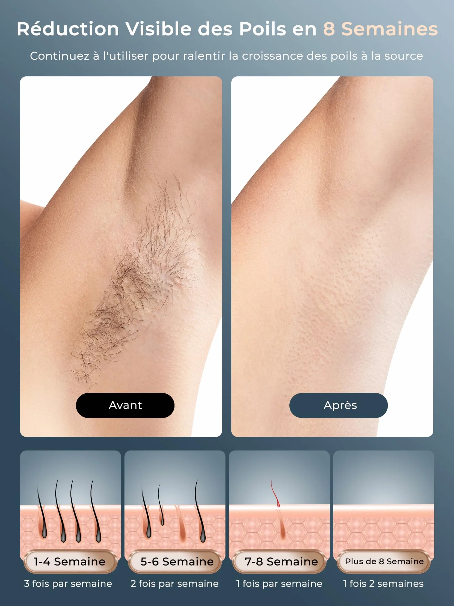 Épilateur Lumière Pulsée avec Fonction de Refroidissement, Épilation Laser sans Douleur avec 9 Niveaux D'énergie pour Femmes et Hommes, Visage, Aisselles, Bikini, Jambes, Corps, Blau