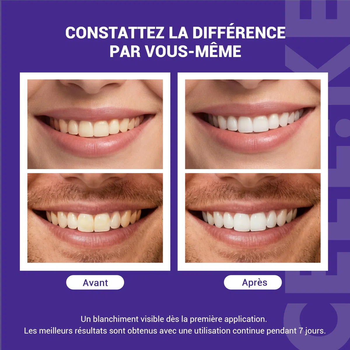 Bandes blanchissantes violettes pour les dents - PAP + nHAP - Technologie violette correctrice - 42 bandes (21 utilisations) - Adaptées aux dents sensibles