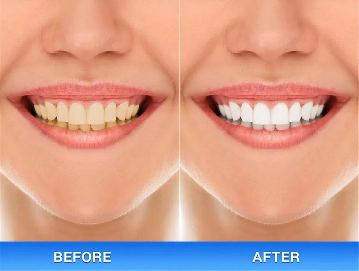 Dentifrice au 3.3-diindolylméthane, Dentifrice à l'hydroxyapatite, Réparateur et blanchissant naturel, Répare les dents abîmées, Élimine les taches, Rafraîchit l'haleine