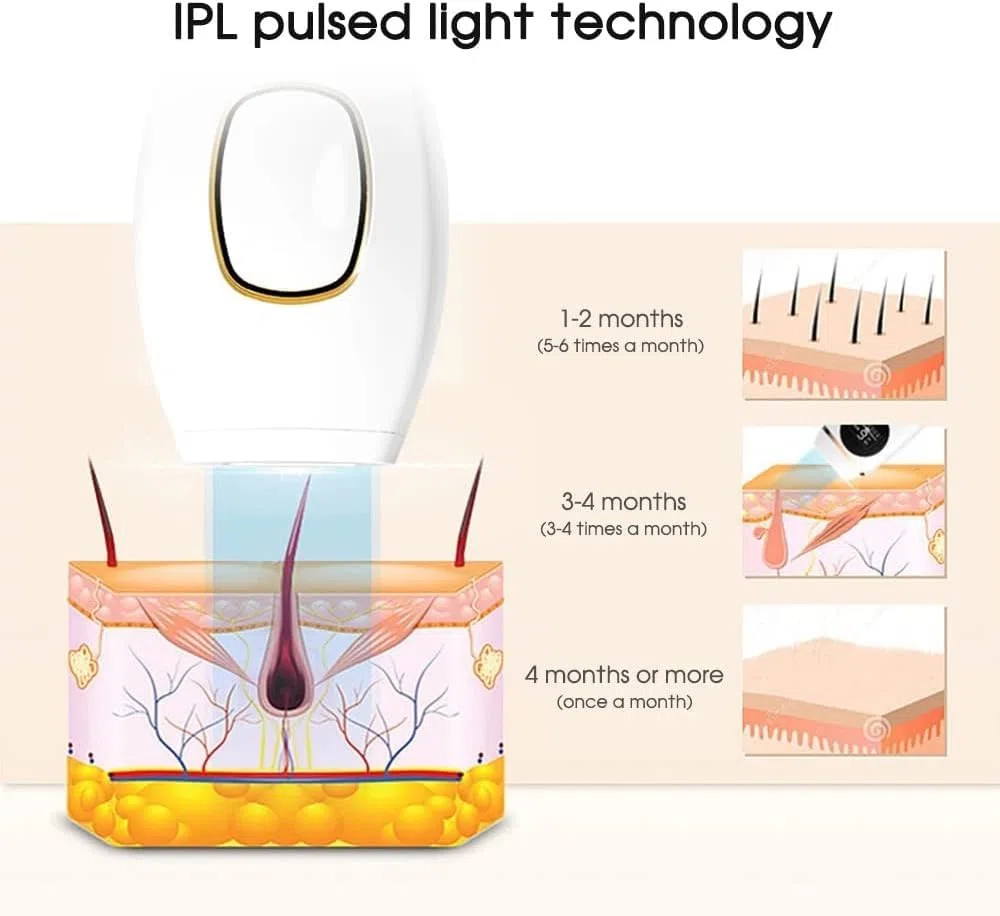 Epilateur à LumièRe PulséE Ipl, 990,000 Flashs Ipl Epilateur Laser Permanente Indolore, 2 Modes 5 Niveaux D'éNergie Epilateur Permanente Pour Femme Et Homme, Corps, Visage, Aisselles, Maillot