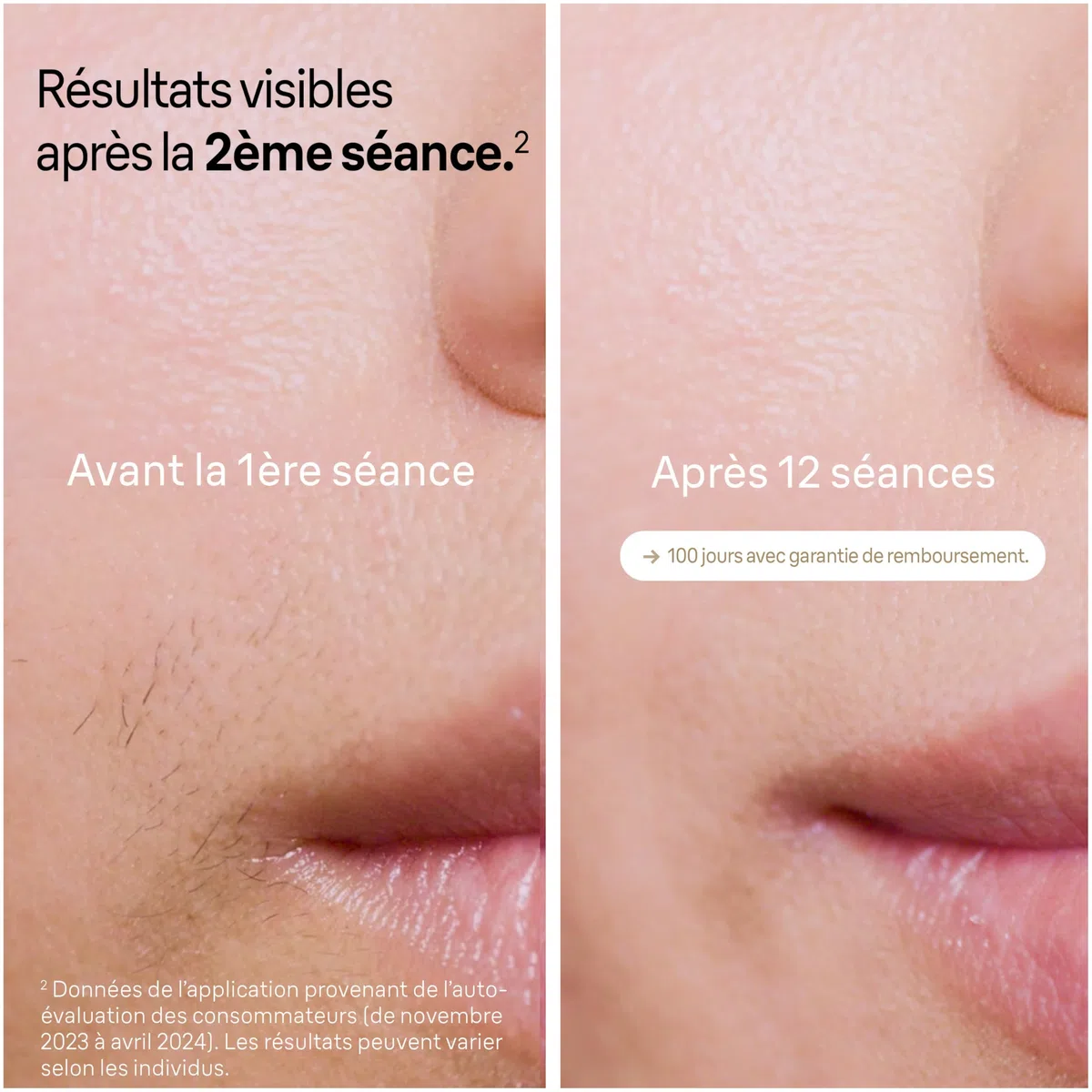 Braun Epilateur Lumiere Pulsee Silk·expert Pro 5 PL5140, Epilation Semi-Définitive, Alternative Au Laser, Résultats En 2 Séances, Rasoir Venus, 2 Têtes Pour Epiler Jambes, Visage, Maillot Et Plus
