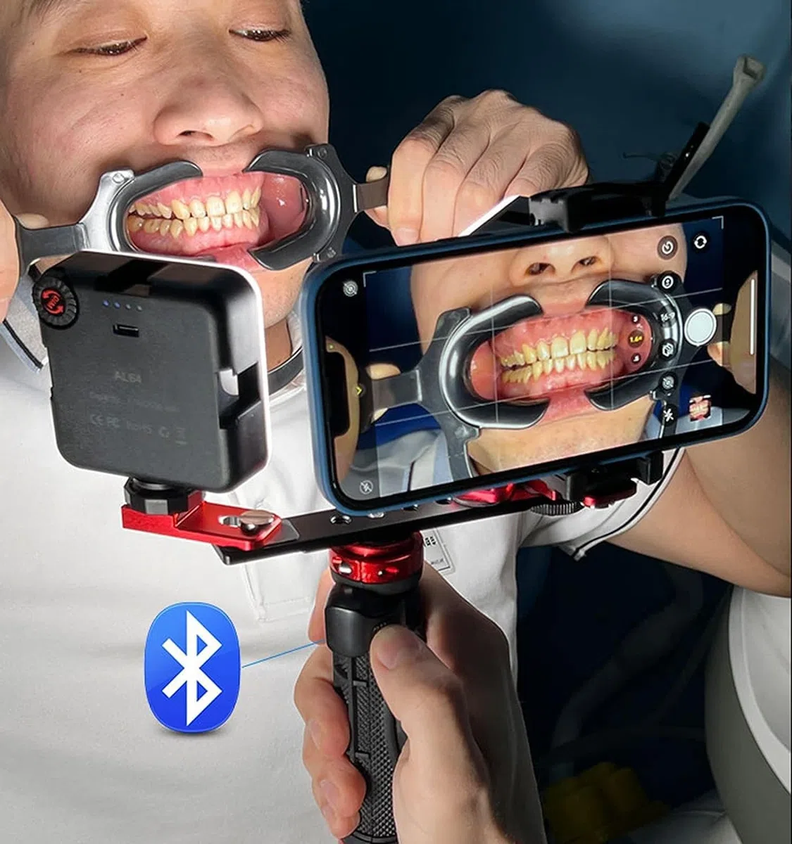 Kit de photographie dentaire – Téléphone portable double lumière avec poignées Bluetooth pour macro photographie dans les cliniques dentaires, soins bucco-dentaires, nail art, tatouages, insectes