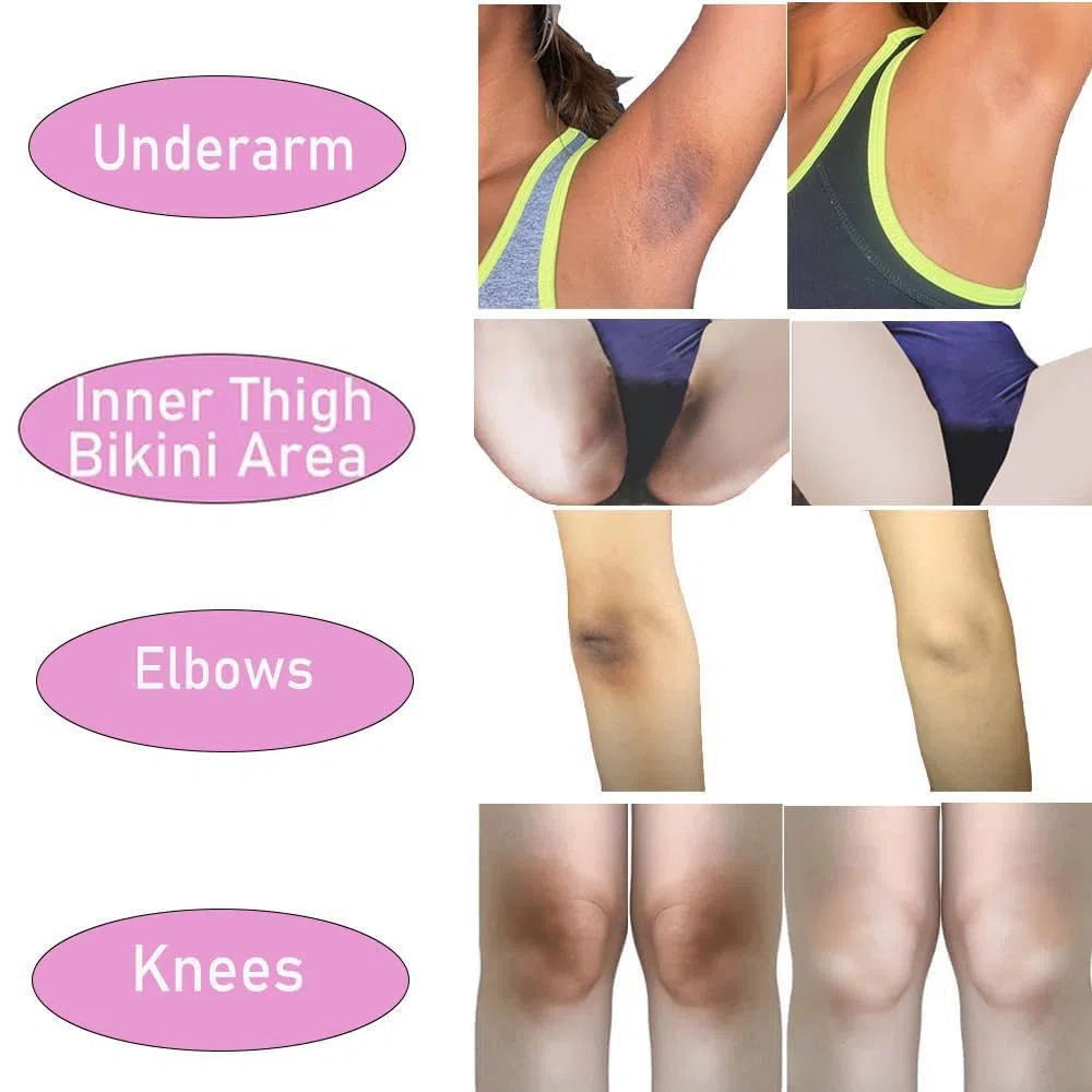 Yana Beauty Vaginal Pussy Yoni Ass Butt Bum Hips Buttock Booty Sexy Bum Breast Bust Boobs Intimate & Private Parts Feminine Bikini Area V part Whitening Lightening Brightening Cream For Women Girls
