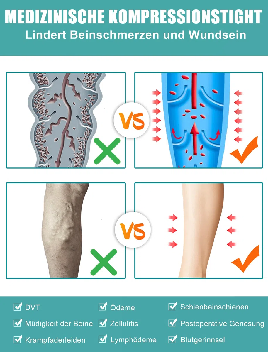 Collants de compression médicaux pour homme et femme - Longueur : 15-20 mmHg - Classe I - Bas de compression gradués - Bout ouvert - Pour la grossesse, les varices, l'œdème, le lipœdème