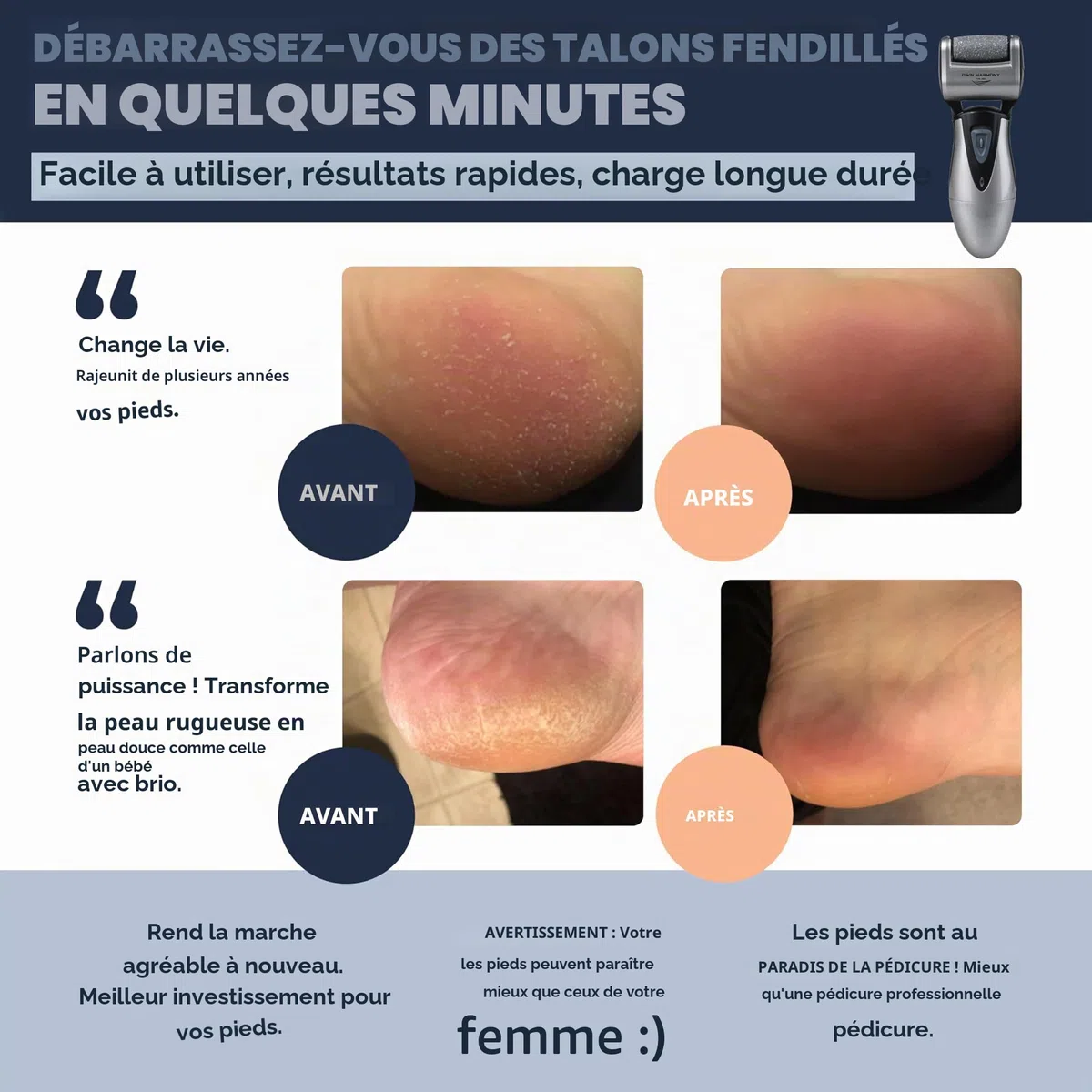 Rapeuse Pieds Electrique pour Hommes par Own Harmony - Rappe Pieds Pédicure Rechargeables et Soins des Pieds avec 3 Rouleaux - Kit Pedicure Professionnel pour Peau Morte, Sèche, Dure (Câble USB)