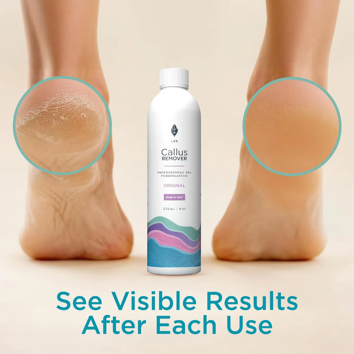 Le meilleur liquide et gel anti-callosités et anti-callosités de Lee Beauty Professional pour les cors et les callosités des pieds fait un meilleur travail qu'un rasoir électrique et une lime à pieds