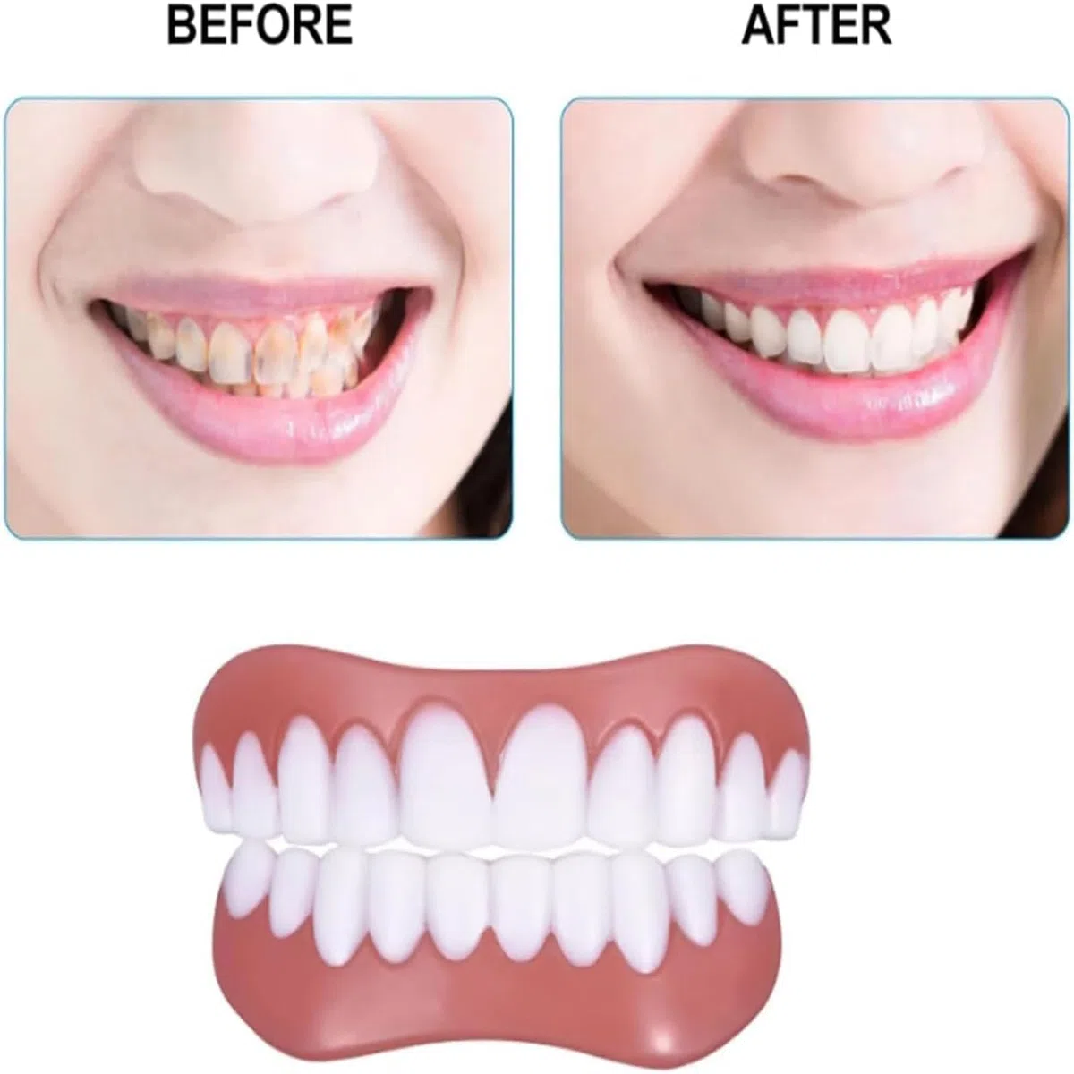 Biancat Greatfit Kit de 5 cordes dentaires en silicone Yunpso - Kit de tendage dentaire en silicone naturel et confortable - Veneers inférieurs et doux - Pour rendre votre sourire plus confiant