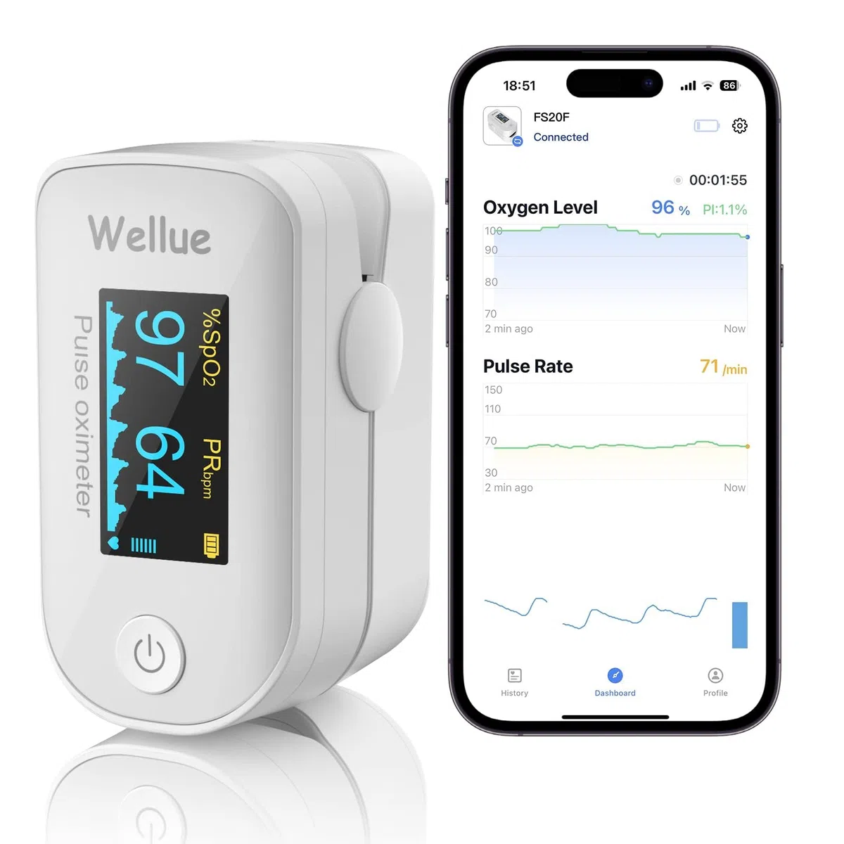 ViATOM Oxymètre de Pouls Bluetooth avec Rapport, Oxymètre de Doigt Saturometre, Moniteur de Fréquence Cardiaque avec Écran LED avec Piles, pour Mesurer Saturation en Oxygène (SpO2, PR et PI), Blaco