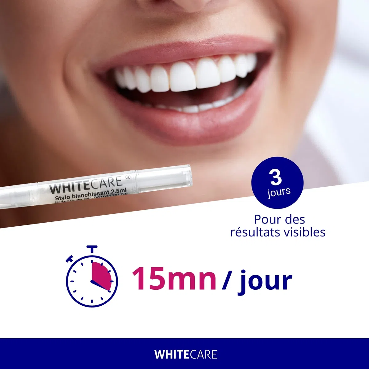 WhiteCare Box Kit Blanchiment Dentaire Professionnel, Menthe, Transparent