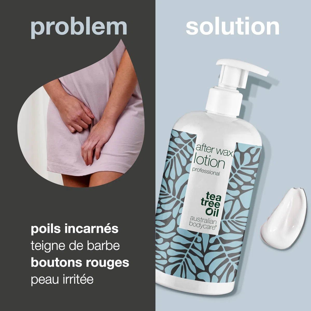 Lotion Après-Épilation Professionnelle, À utiliser après l'épilation à la cire, l'épilation du maillot ou l'épilation brésilienne | Réduit l'apparence des poils incarnés et de l'irritation de la peau