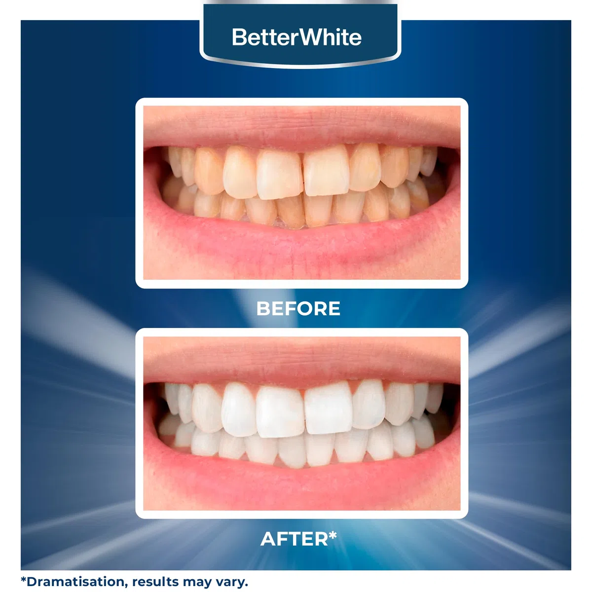 BetterWhite Professional Teeth Whitening Strips 21 Treatments - Enamel Safe - Non-Sensitive Formula - 42 Peroxide-Free Strips - Dentist Formulated Teeth Whitening Kit + Mouth Opener Included