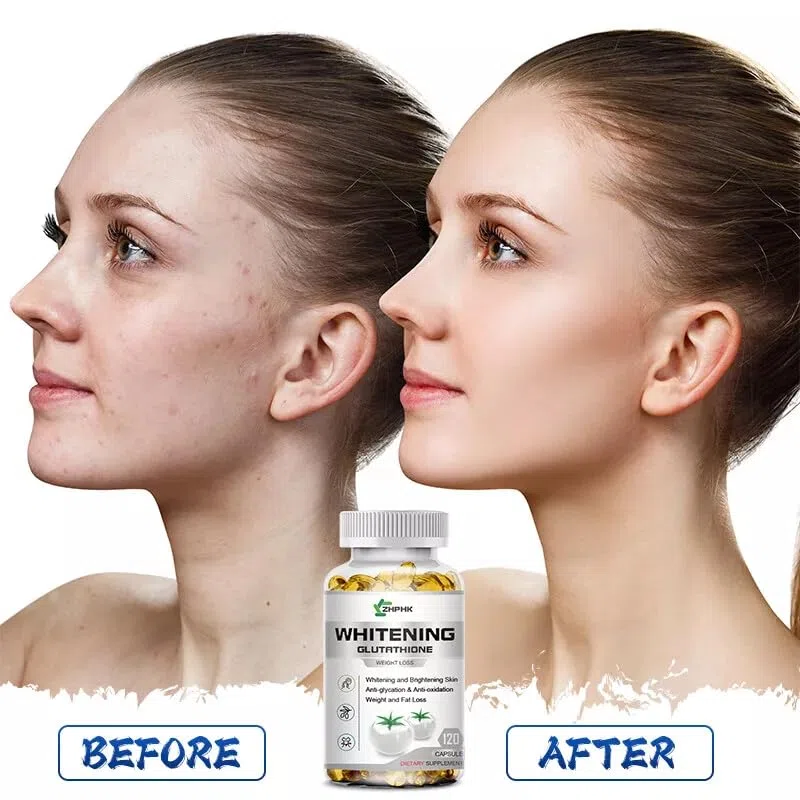 Meilleur glutathion peau blanchissant le supplément anti-âge naturel de pilules pour la beauté